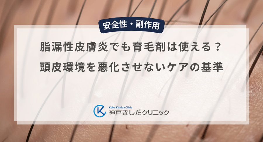 脂漏性皮膚炎でも育毛剤は使える?頭皮環境を悪化させないケアの基準