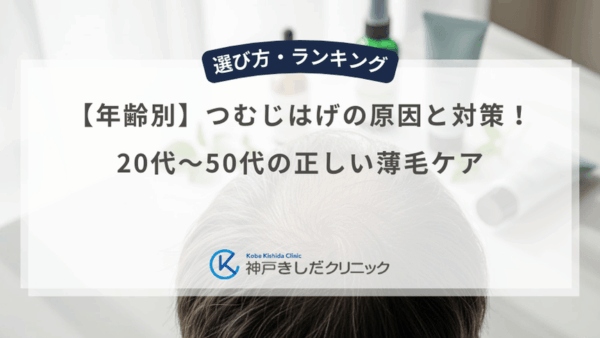 【年齢別】つむじはげの原因と対策！20代〜50代の正しい薄毛ケア