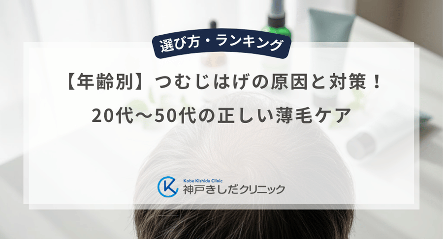 【年齢別】つむじはげの原因と対策！20代〜50代の正しい薄毛ケア
