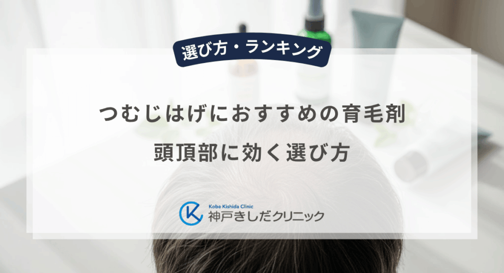 つむじはげにおすすめの育毛剤｜頭頂部に効く選び方
