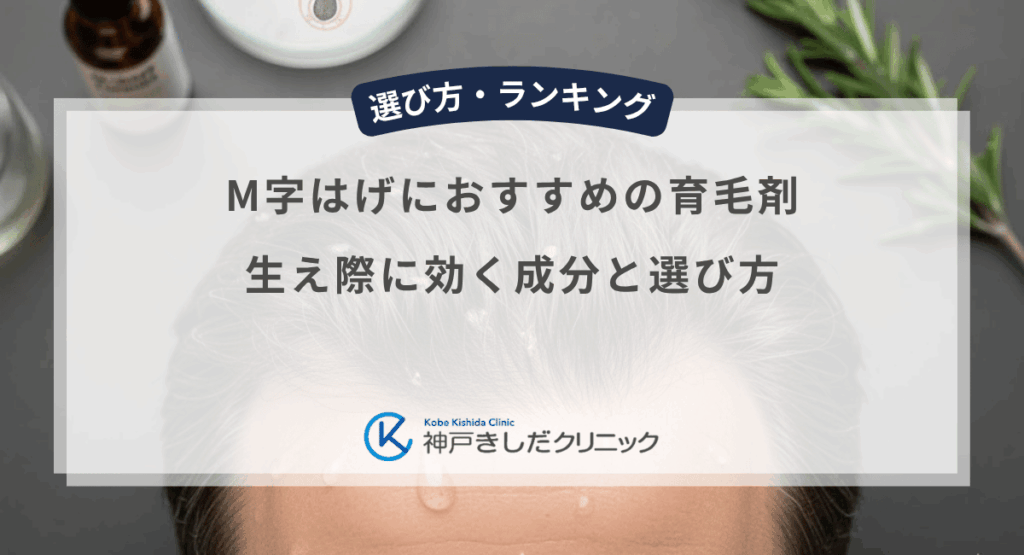 M字はげにおすすめの育毛剤｜生え際に効く成分と選び方