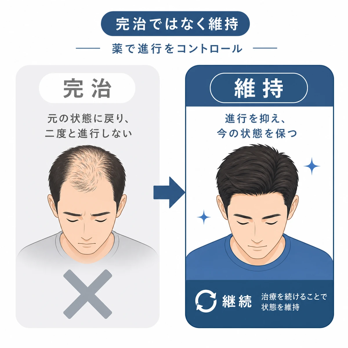 AGAは完治ではなく治療で毛量を維持する考え方を表した医療イラスト