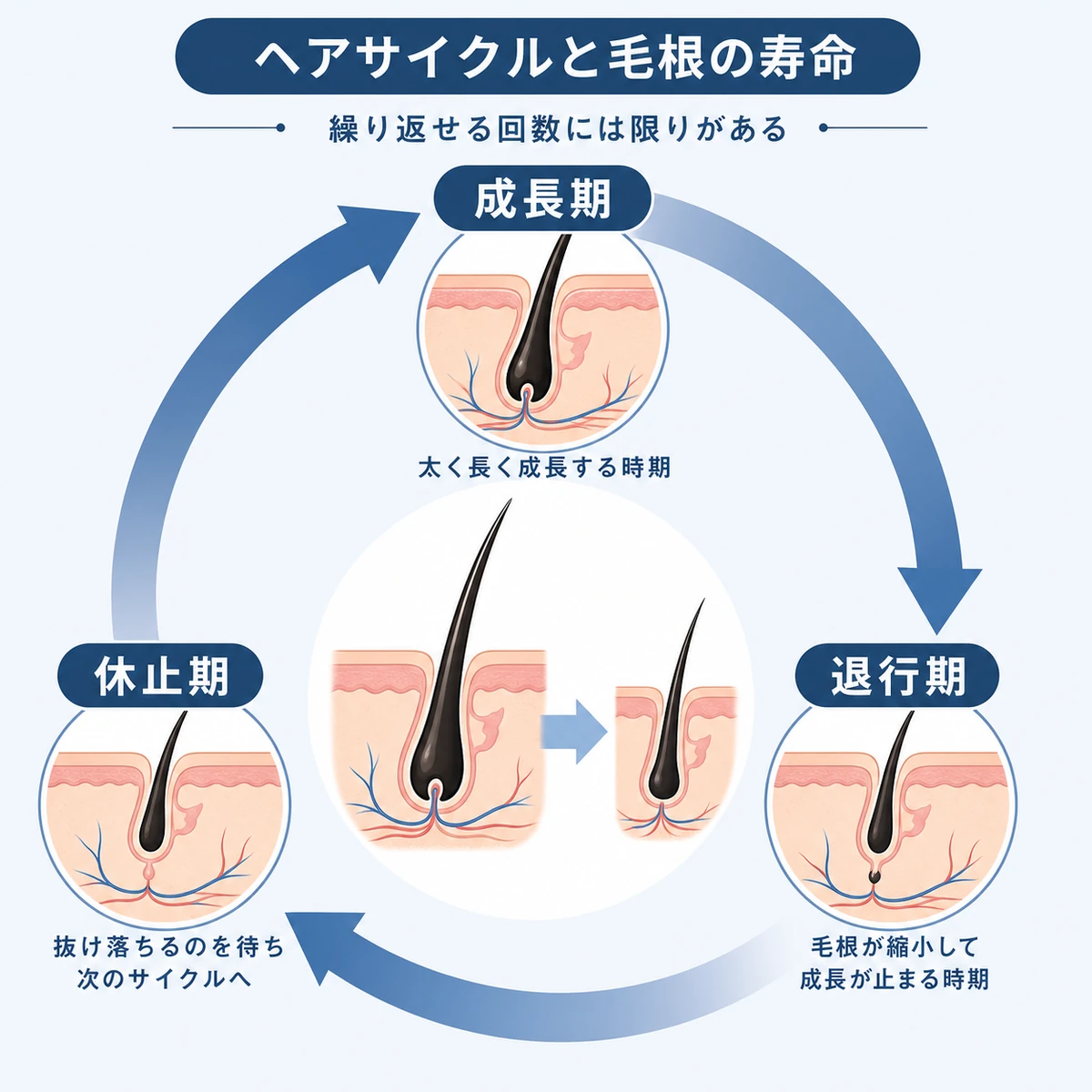 ヘアサイクルの巡りと毛根の寿命の関係を表した医療イラスト
