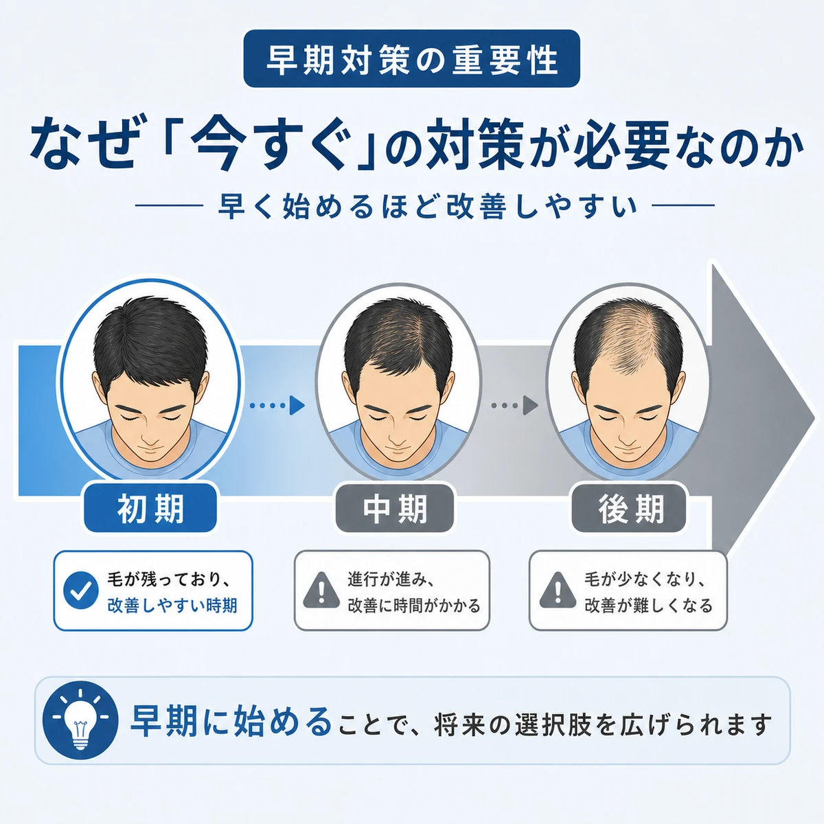 AGAの進行段階ごとに対策のしやすさが変わる様子を表した医療イラスト