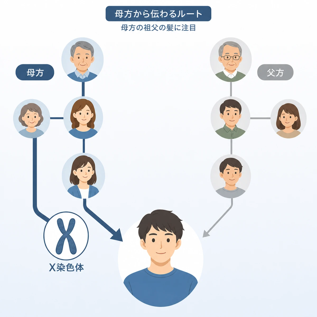 母方のX染色体を通じてAGAの体質が本人へ伝わる遺伝ルートを示した医療イラスト