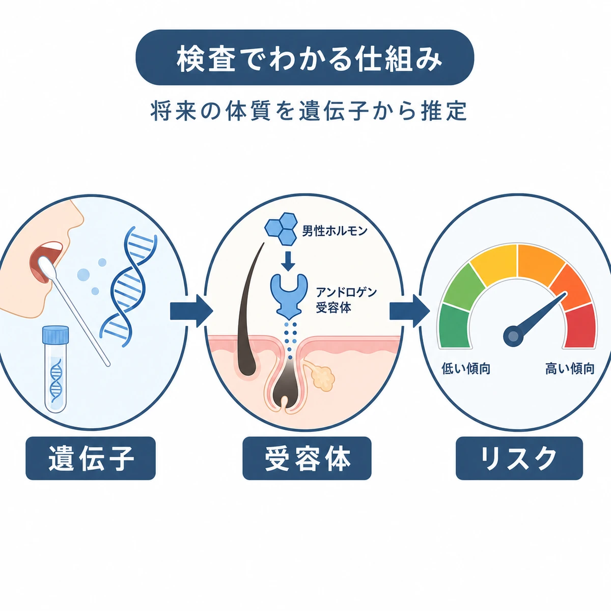 遺伝子から薄毛のなりやすさを推定する仕組みを表した医療イラスト
