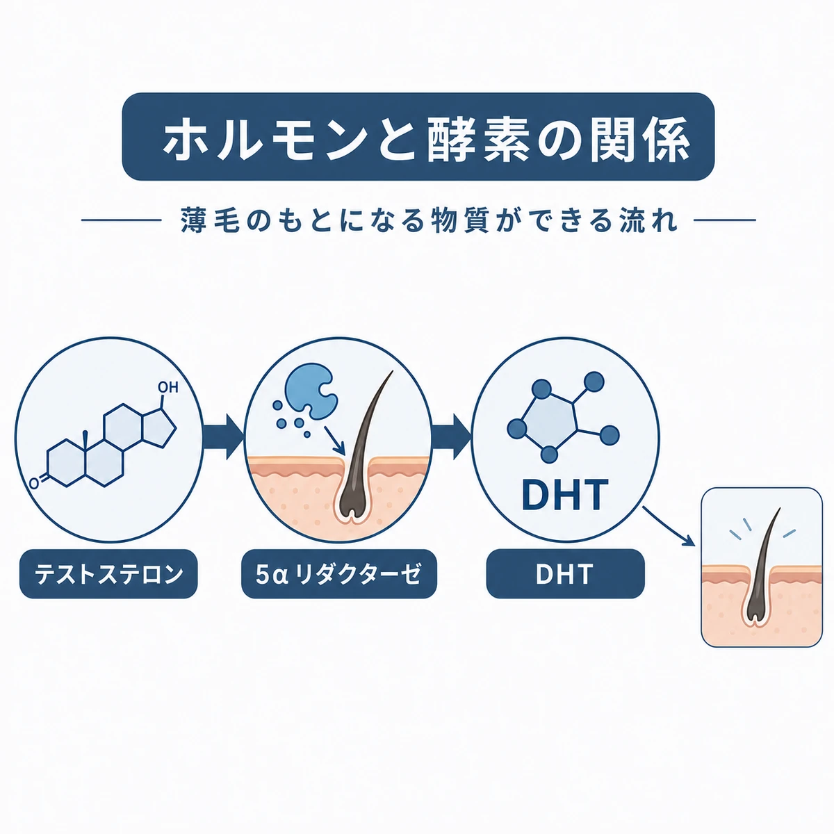 テストステロンが酵素と結びついてDHTに変化し薄毛につながる流れを表した医療イラスト