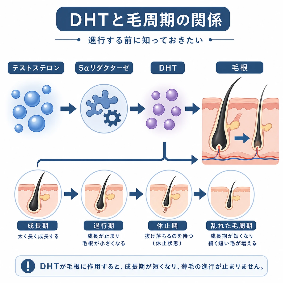 テストステロンがDHTに変化して毛周期を乱す仕組みを表した医療イラスト