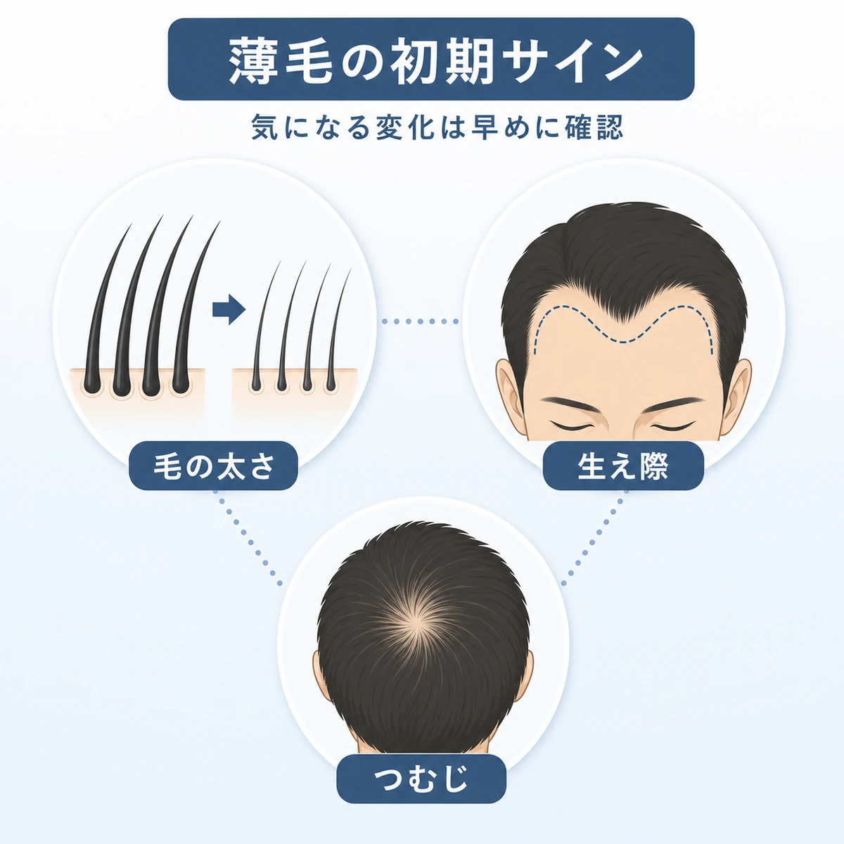 抜け毛の太さや生え際の後退などAGA初期サインのセルフチェックを表した医療イラスト