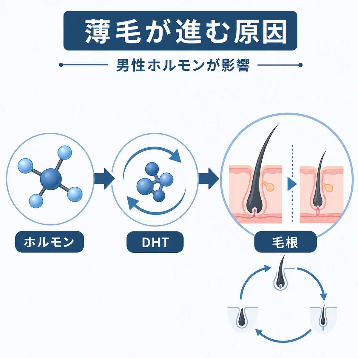 男性ホルモンからDHTが作られ毛根に影響する流れを表した医療イラスト