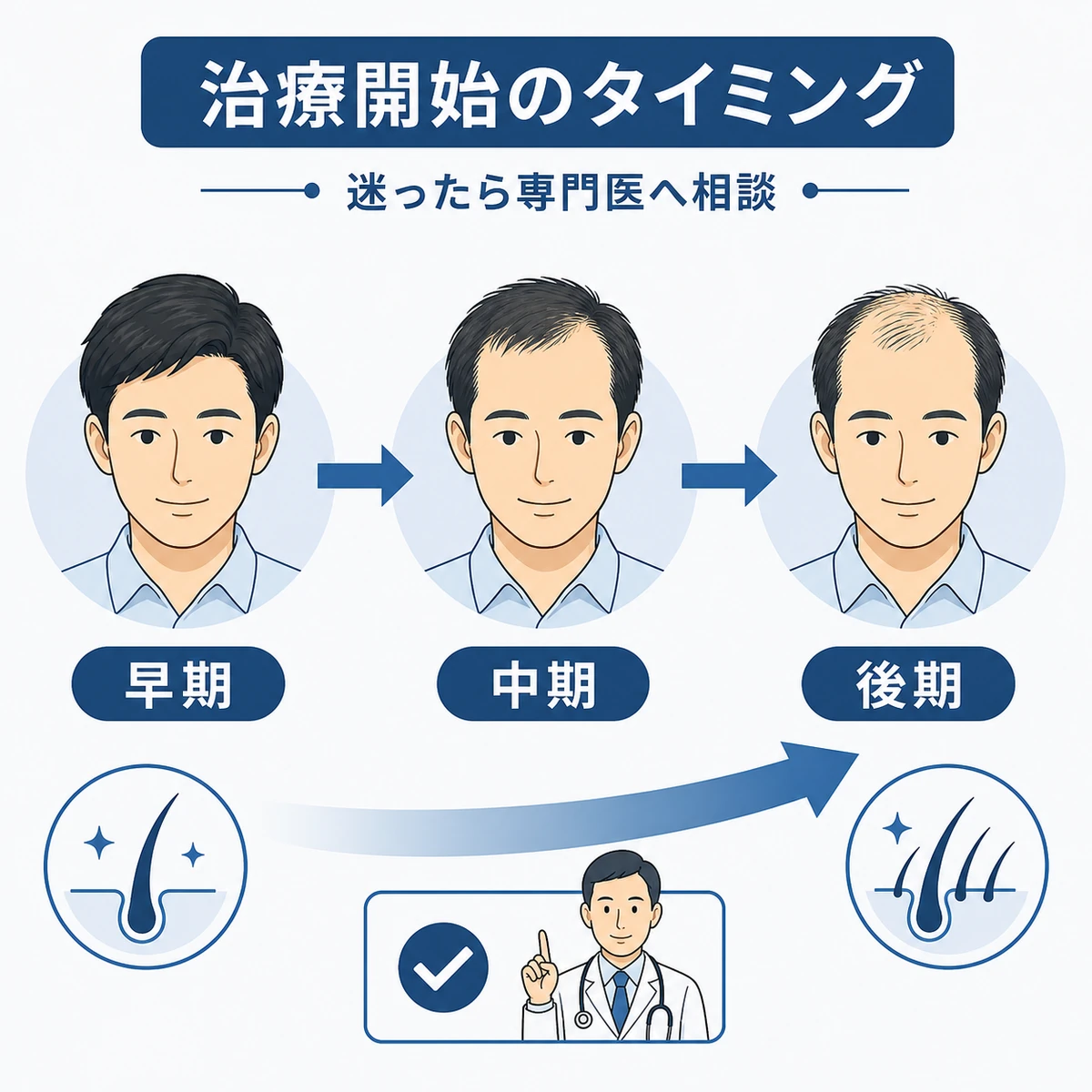 AGA治療の開始時期による効果の違いを段階で表した医療イラスト