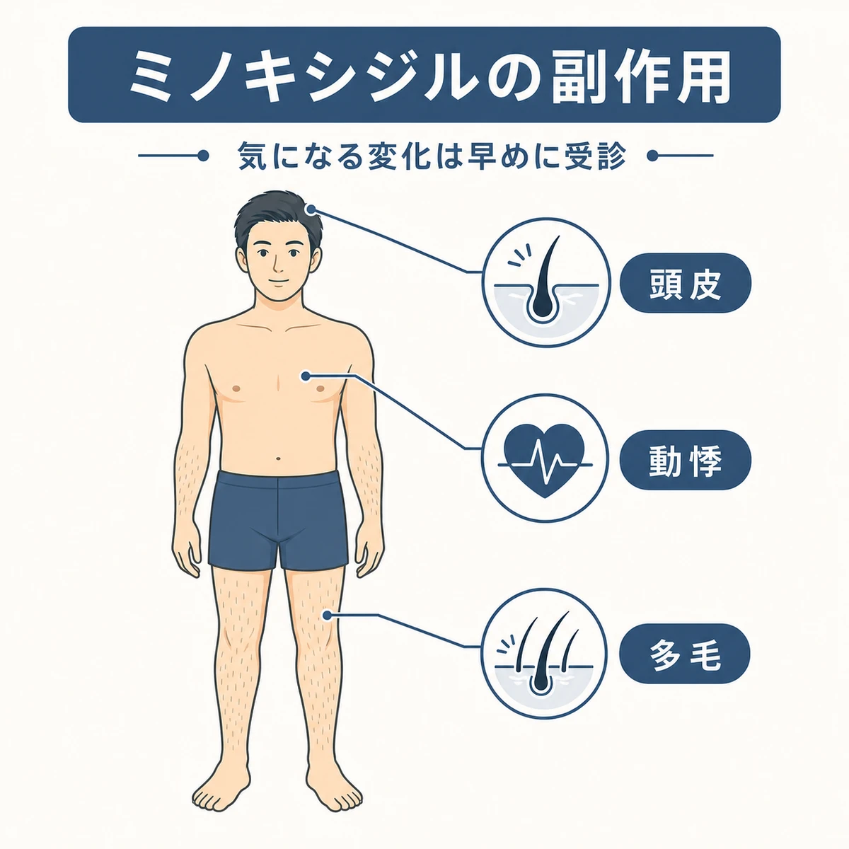 ミノキシジルで起こりうる頭皮や全身の症状を表した医療イラスト