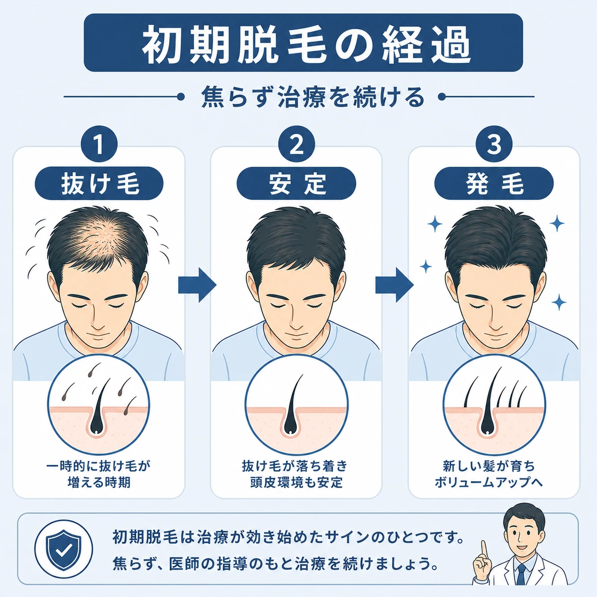 初期脱毛から新しい毛が生えそろうまでの経過を段階で表した医療イラスト