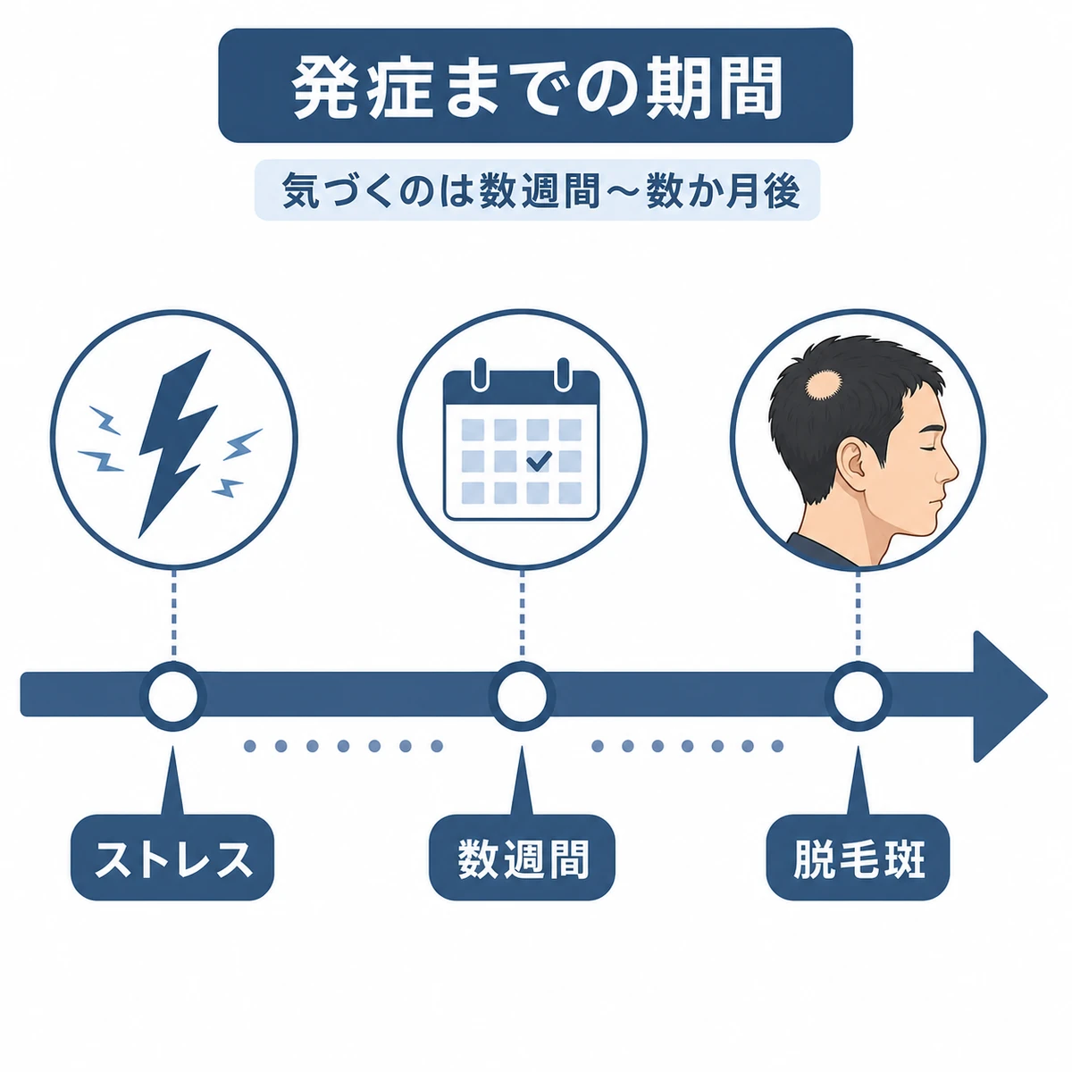 ストレスを受けてから脱毛が現れるまでの期間を示したタイムラインの医療イラスト
