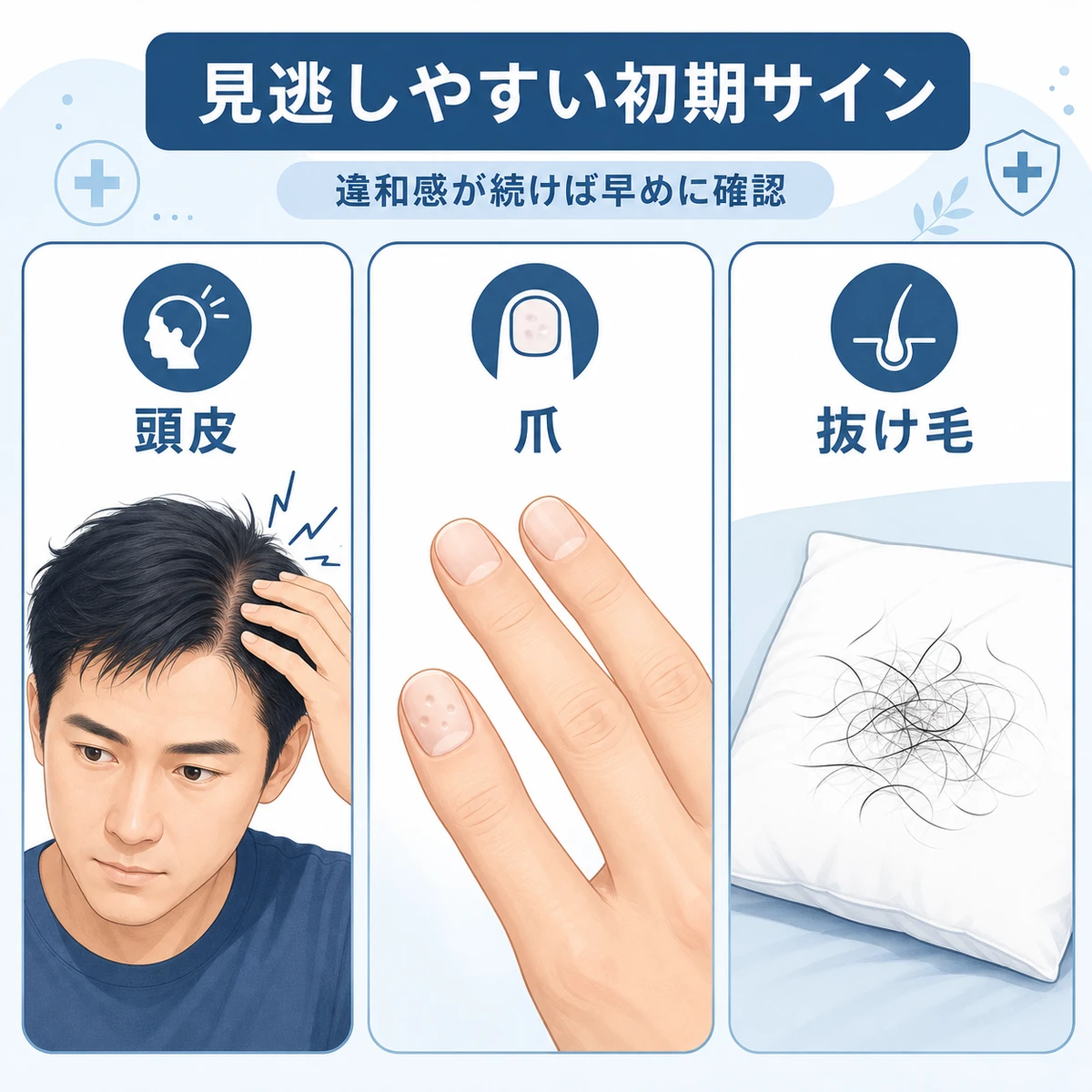 円形脱毛症の初期に現れやすい頭皮や爪のサインをまとめた医療イラスト