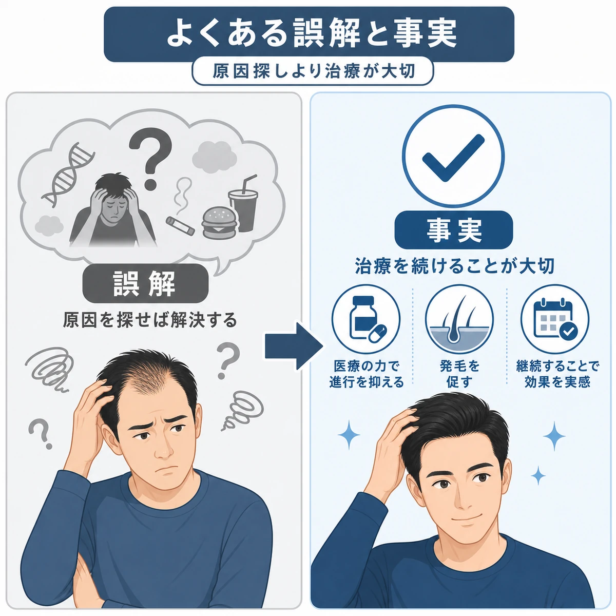 円形脱毛症によくある誤解と実際の事実を対比した医療イラスト