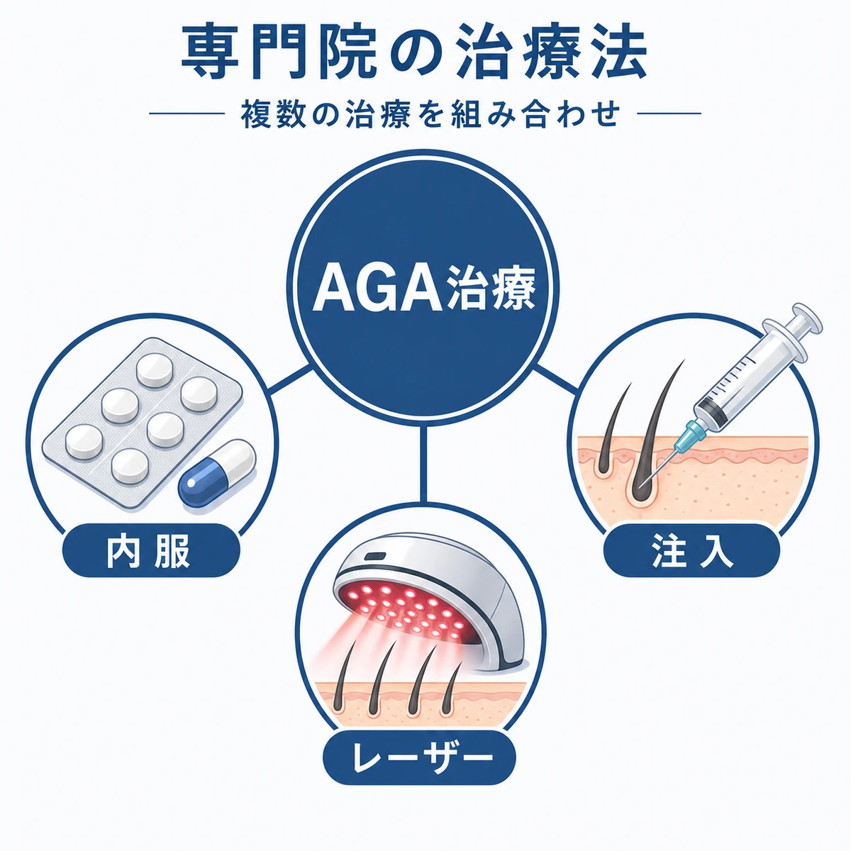 薄毛専門クリニックの内服と注入とレーザーを組み合わせるAGA治療の相関図を描いた医療イラスト