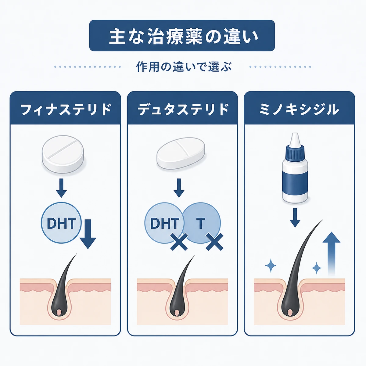 AGA治療で使われる3種類の薬の作用の違いをカードで並べて表した医療イラスト