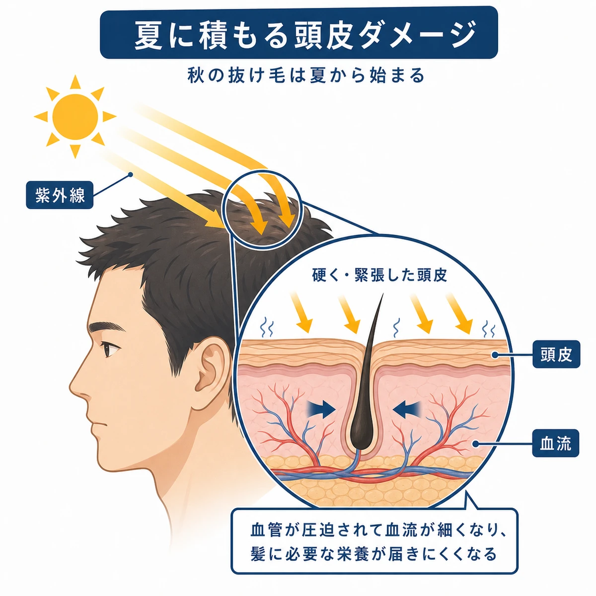 頭皮 から の 汗