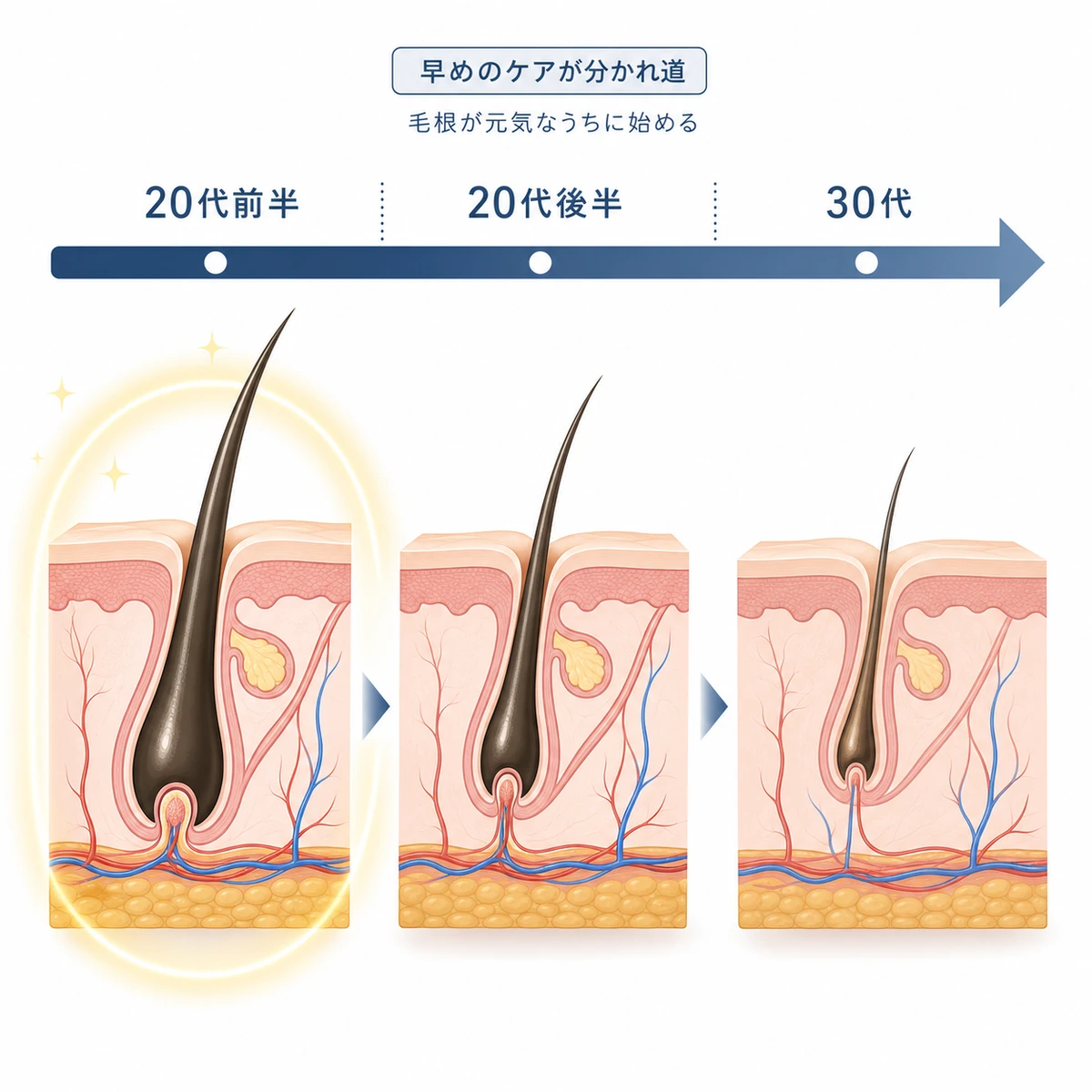 20代から30代にかけて毛根の状態が段階的に変化する様子を時間の流れで表した育毛イラスト