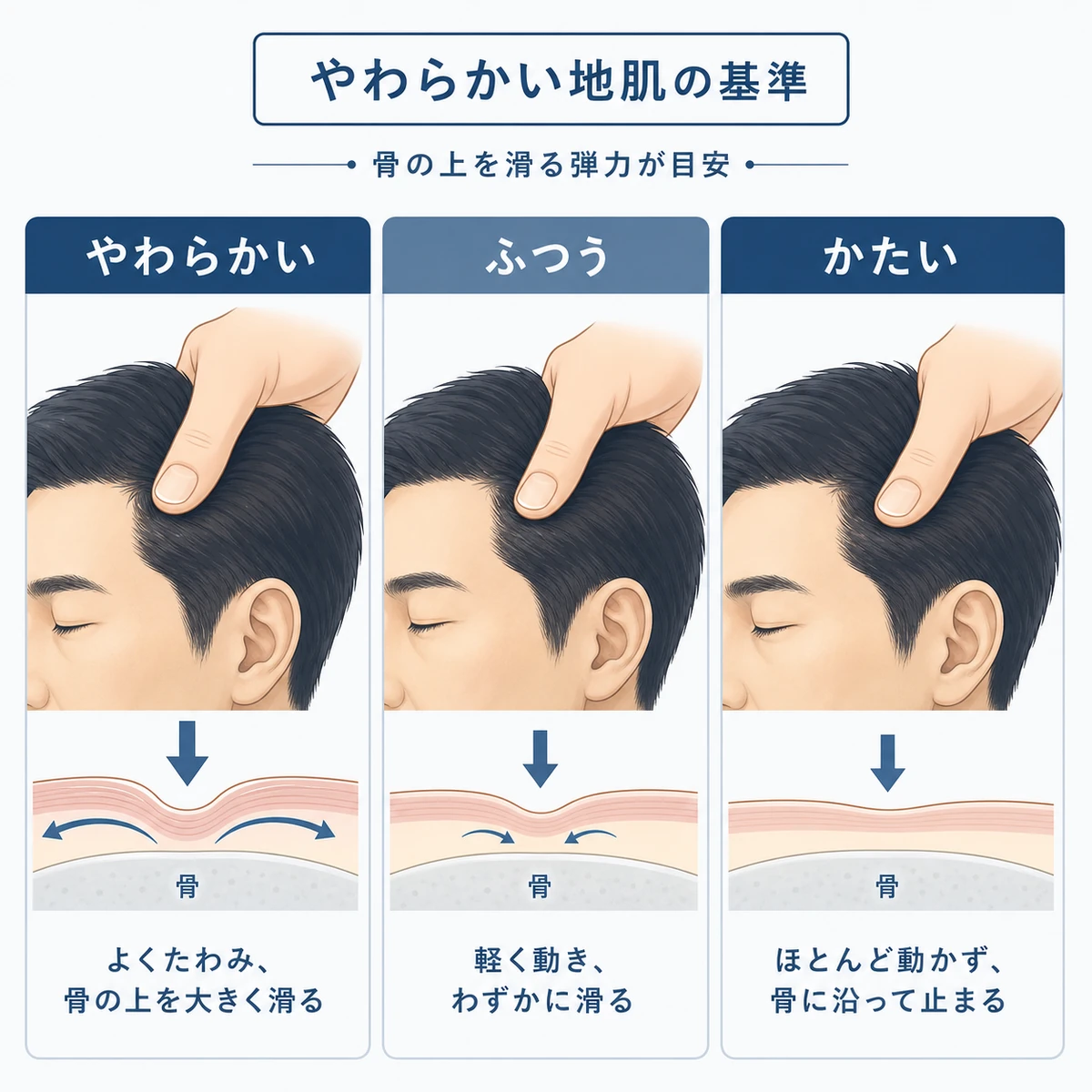 頭皮のやわらかさを三段階で比べた健康な地肌の基準を示した医療イラスト