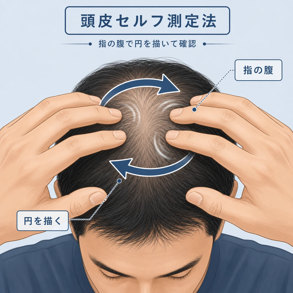 成人男性が指の腹で頭皮を動かしてやわらかさを確かめるセルフチェックの手元を描いた医療イラスト