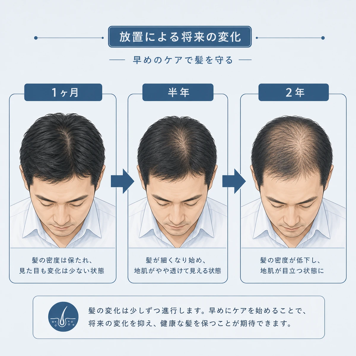 頭皮の硬さを放置した場合の髪の変化を時間の流れで表した医療イラスト
