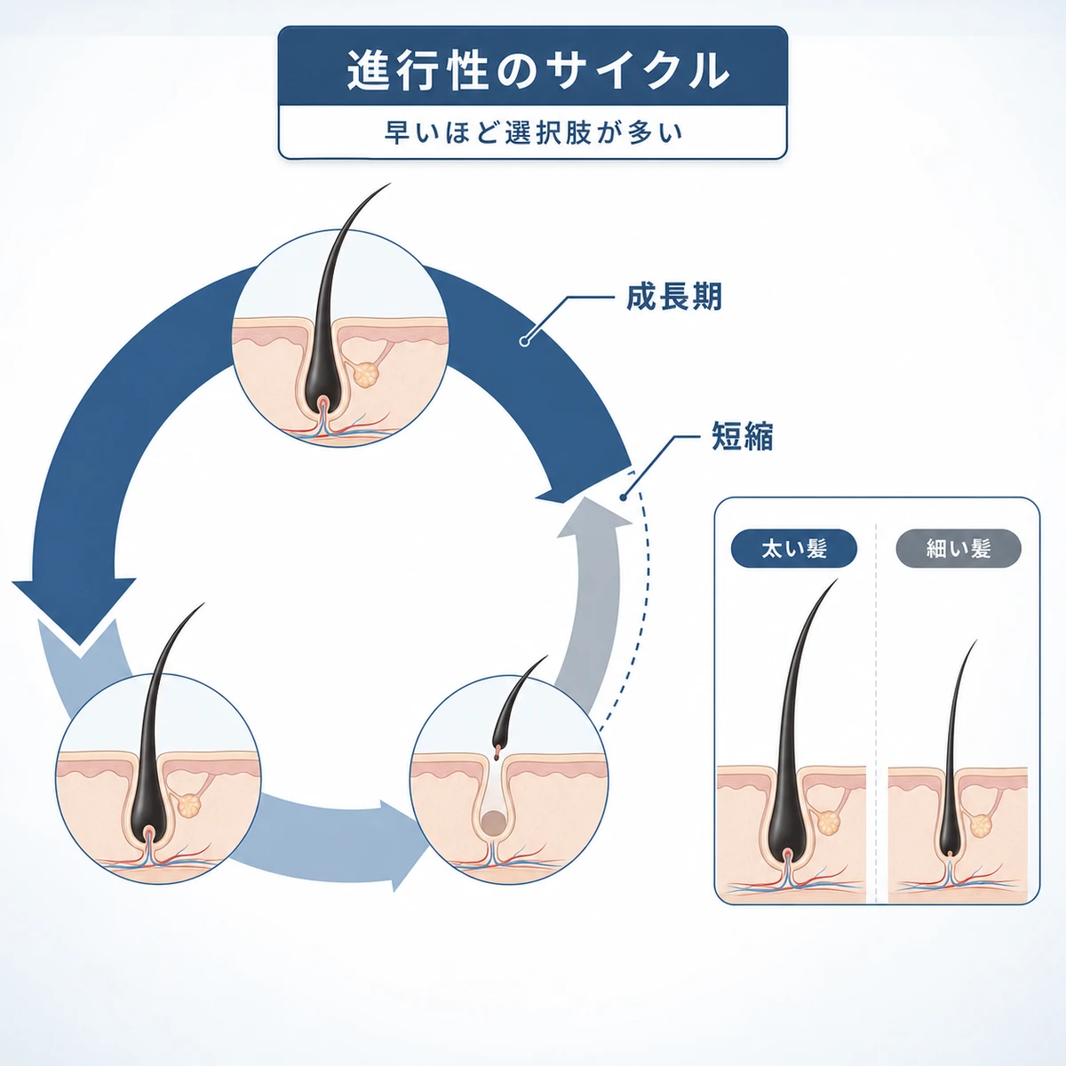 ヘアサイクルの乱れで成長期が短くなる仕組みを表した医療イラスト