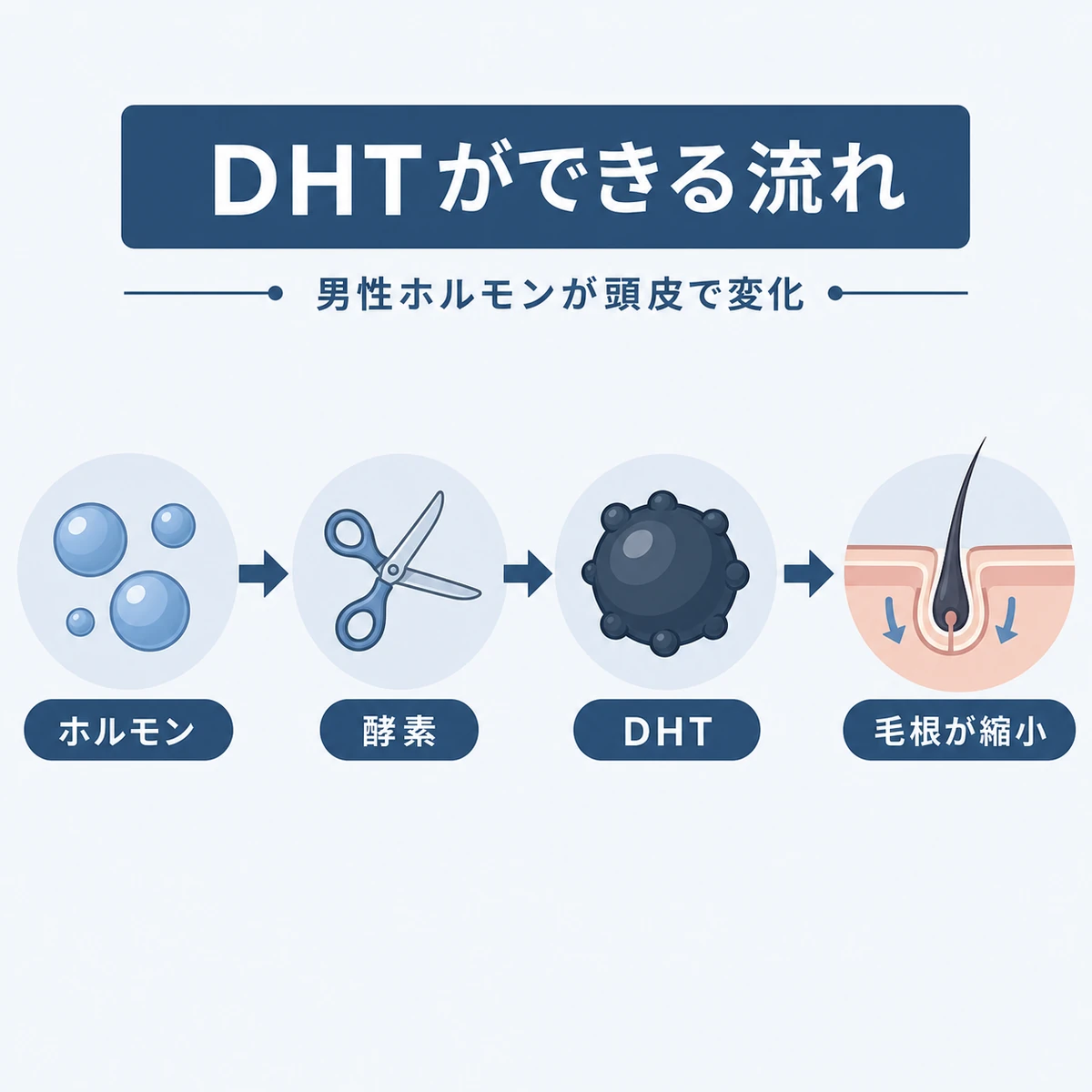 テストステロンが酵素でDHTに変わる仕組みの流れを示した医療イラスト