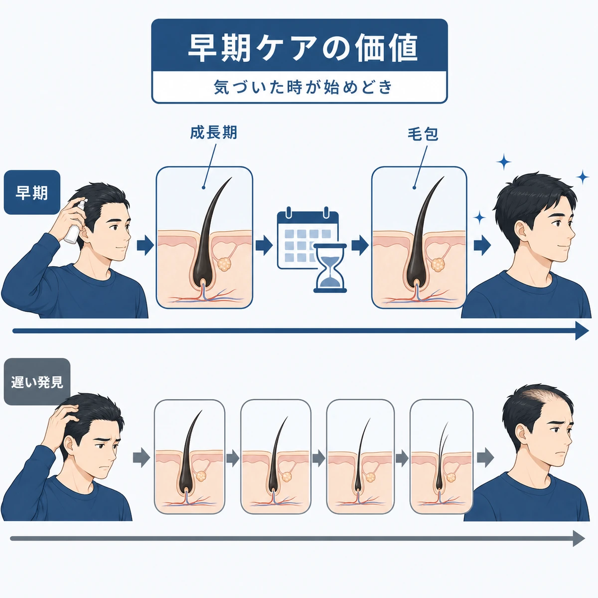 ヘアサイクルが短くなる前に早めのケアで毛包を守る流れを示した医療イラスト