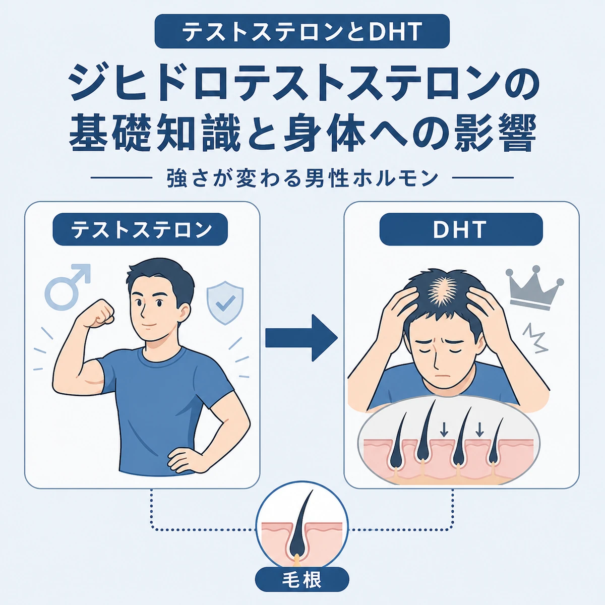 テストステロンが変化してDHTになり毛根へ影響する流れを表した医療イラスト