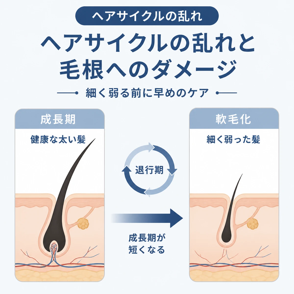 健康な髪と軟毛化した髪を比べヘアサイクルの乱れを表した医療イラスト