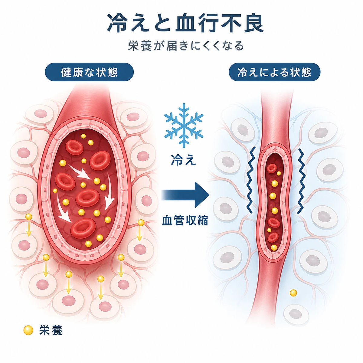 冷えによる血管収縮で頭皮へ栄養が届きにくくなる仕組みを表した医療イラスト