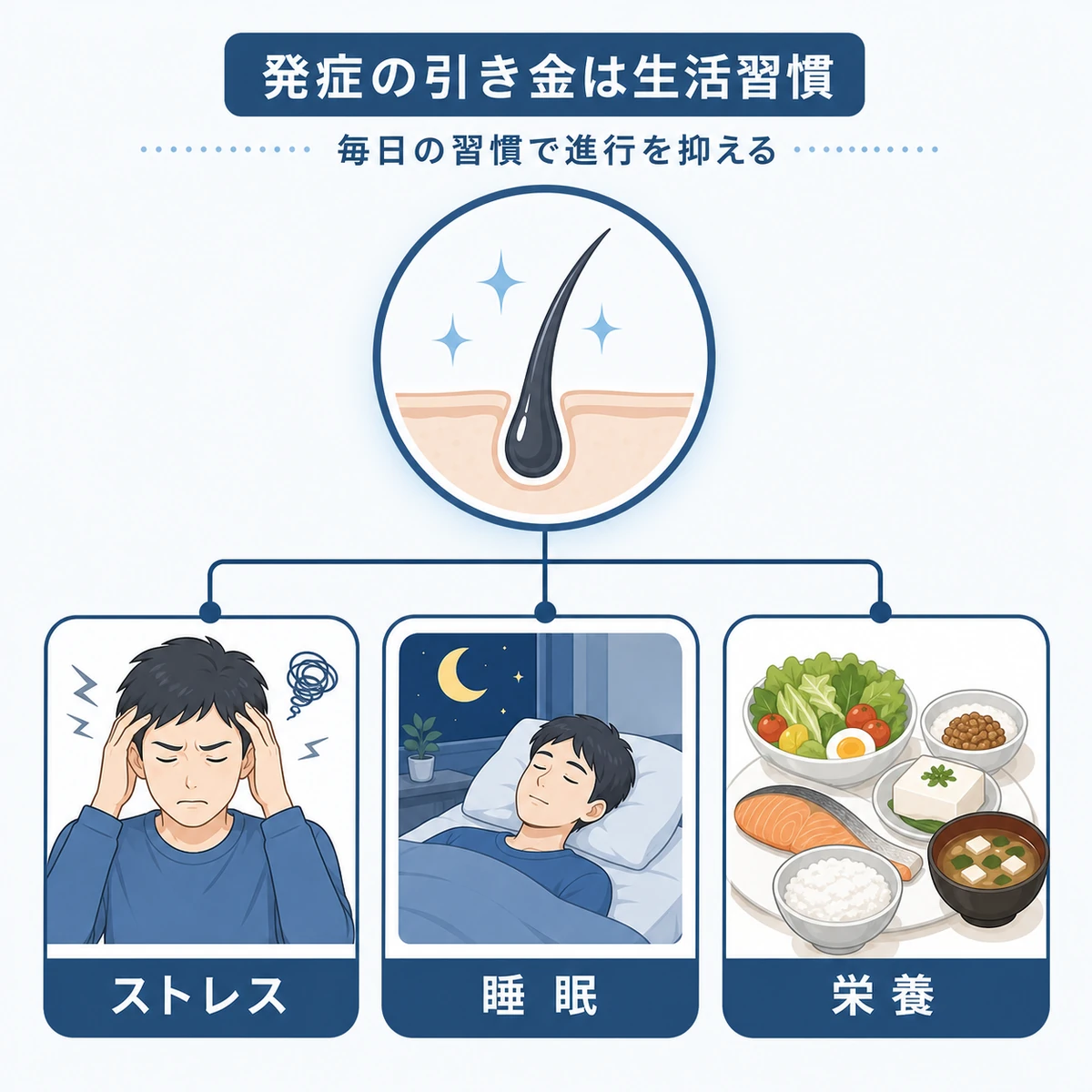ストレスや睡眠不足や栄養の偏りが薄毛の引き金になる様子を表した医療イラスト