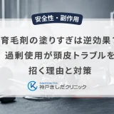 育毛剤の塗りすぎは逆効果？過剰使用が頭皮トラブルを招く理由と対策