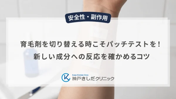 育毛剤を切り替える時こそパッチテストを！新しい成分への反応を確かめるコツ