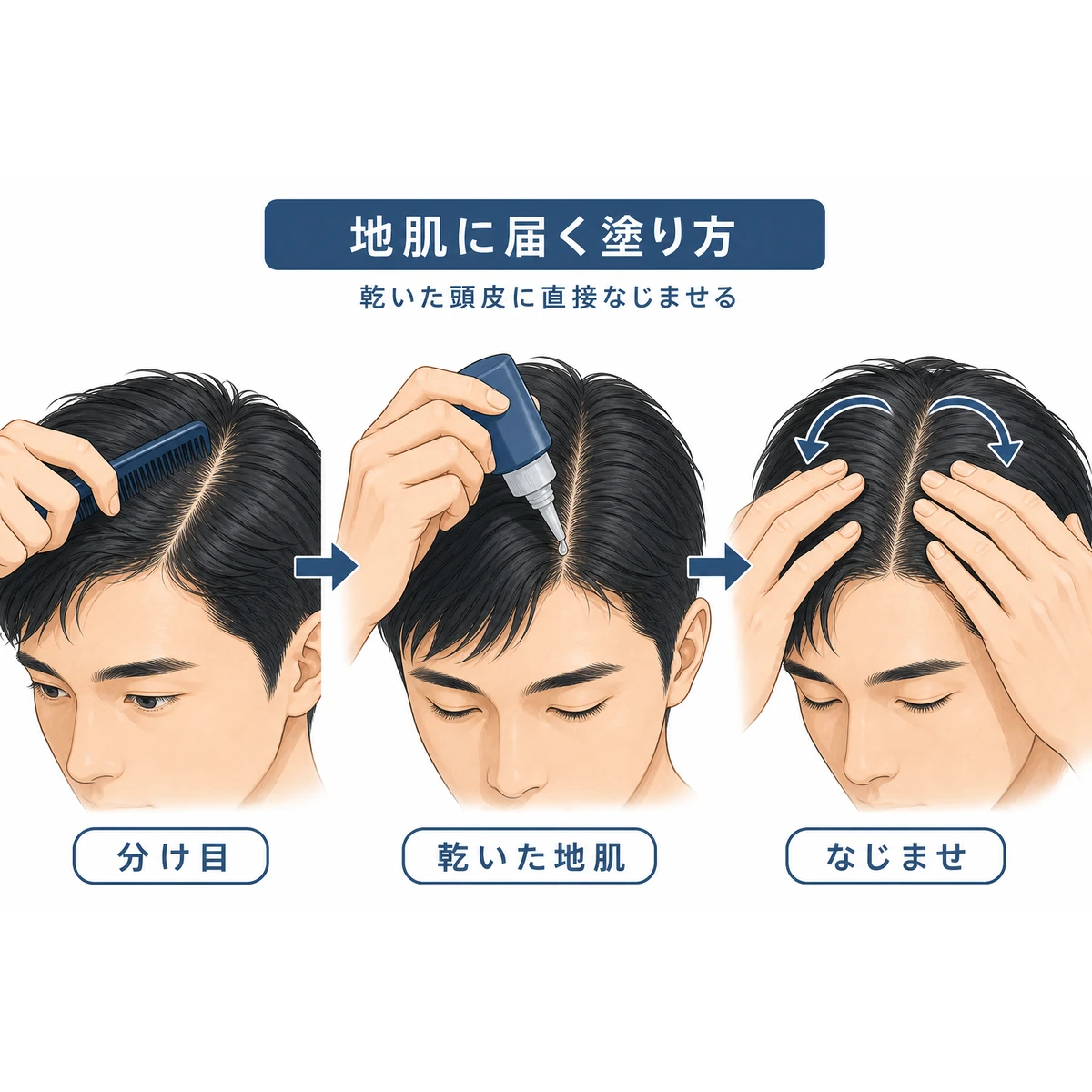 育毛剤を地肌に正しく塗る3つの手順を表した医療イラスト