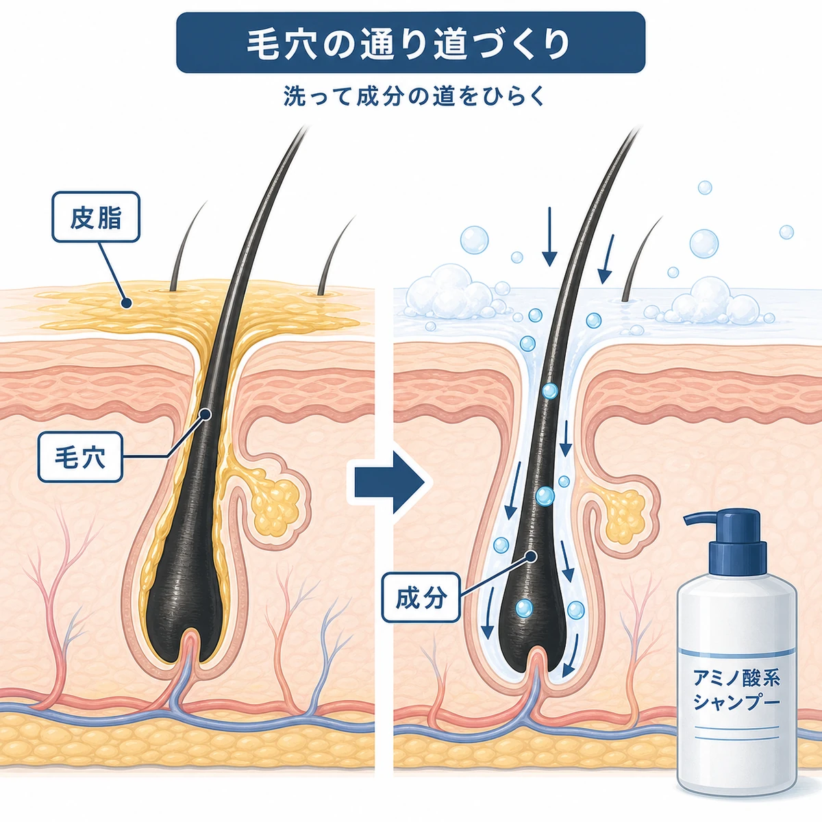頭皮クレンジングで毛穴が開き育毛成分が奥へ届くしくみを表した断面イラスト