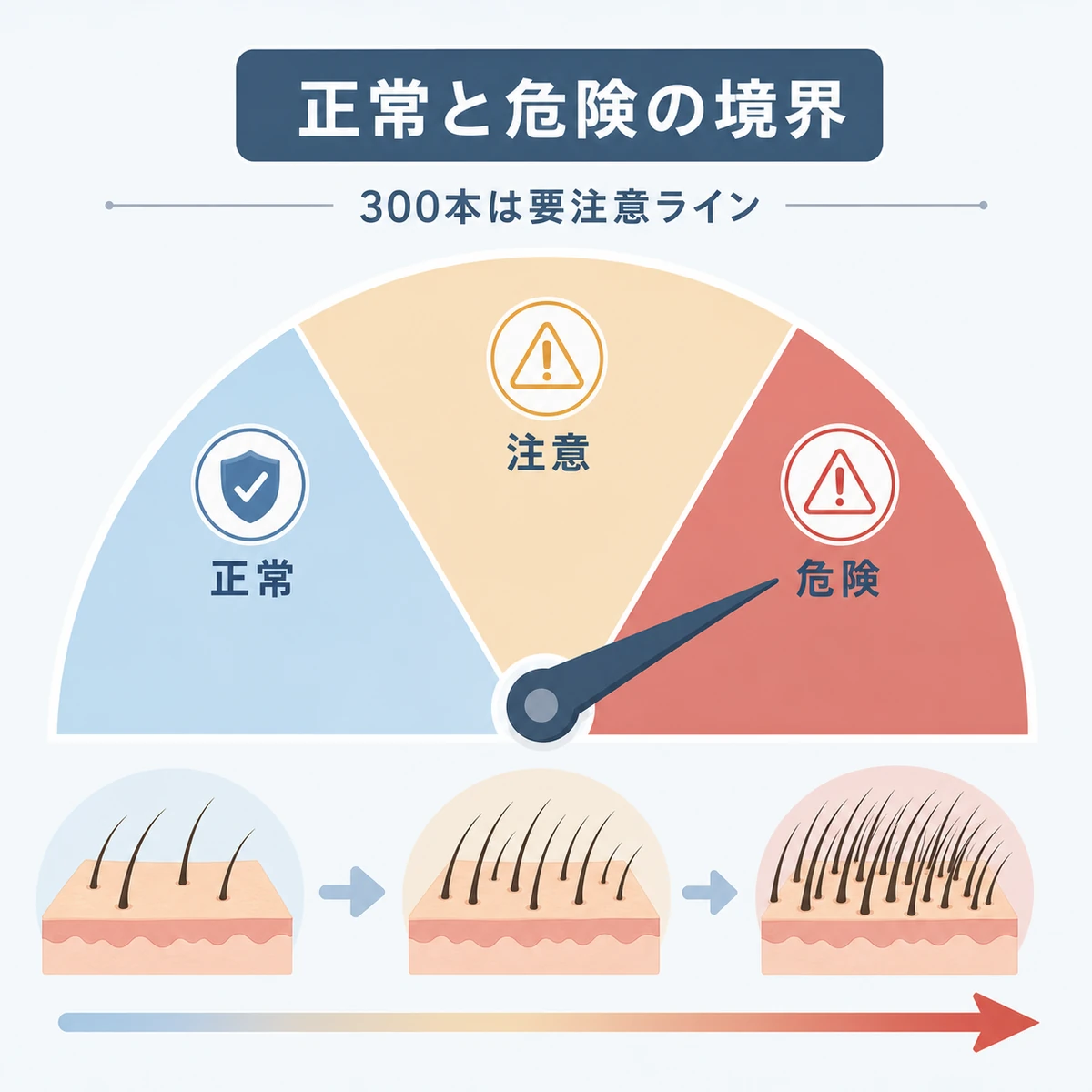 抜け毛の本数が正常ゾーンから危険ゾーンへ移る目安を表した医療イラスト