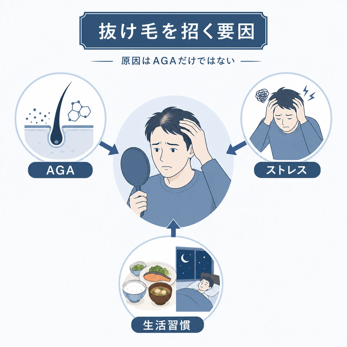 抜け毛が急に増える複数の要因のつながりを示した医療イラスト