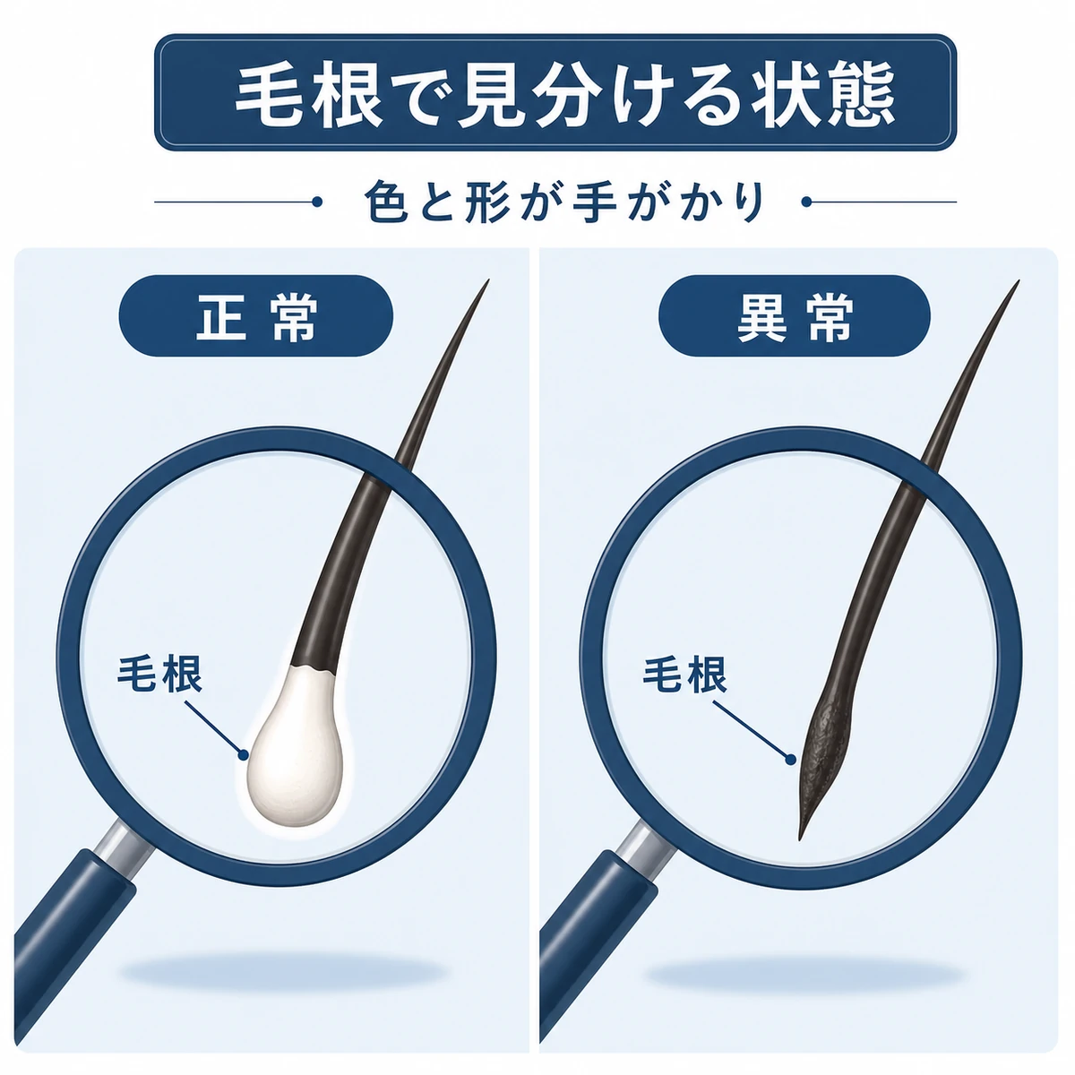 正常な毛根と異常な毛根の違いを並べて比べた医療イラスト