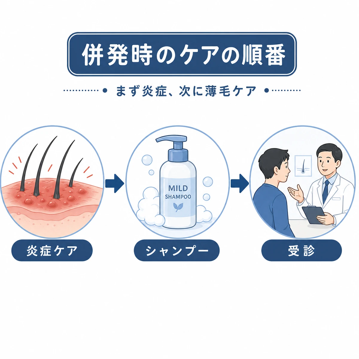 炎症を鎮めてから薄毛治療へ進む併発時のケアの順番を段階で示した医療イラスト