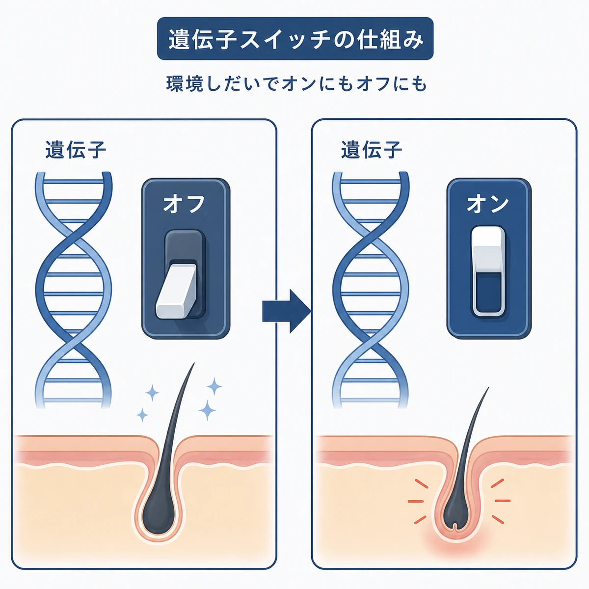 環境要因によって脱毛関連遺伝子のスイッチが切り替わるエピジェネティクスを表した医療イラスト