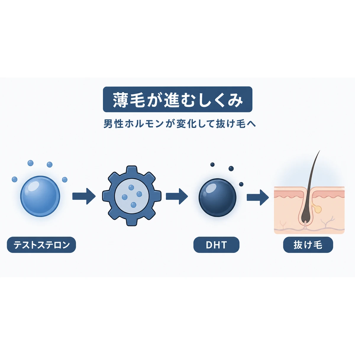 男性ホルモンがDHTに変化して抜け毛につながる流れを描いた医療イラスト