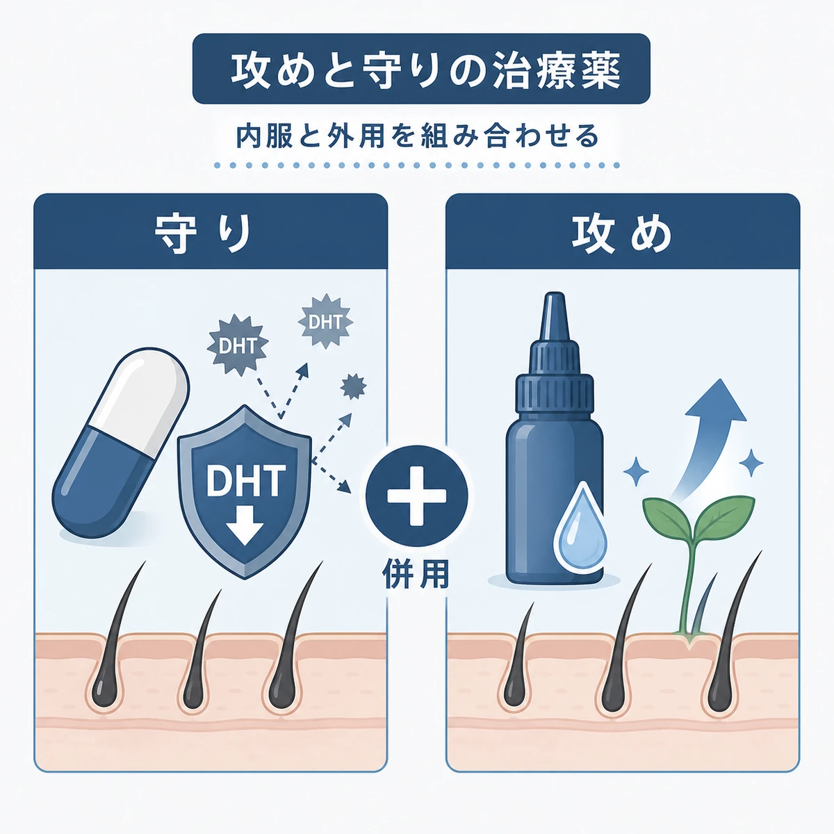 抜け毛を防ぐ内服薬と発毛を促す外用薬を対比した医療イラスト