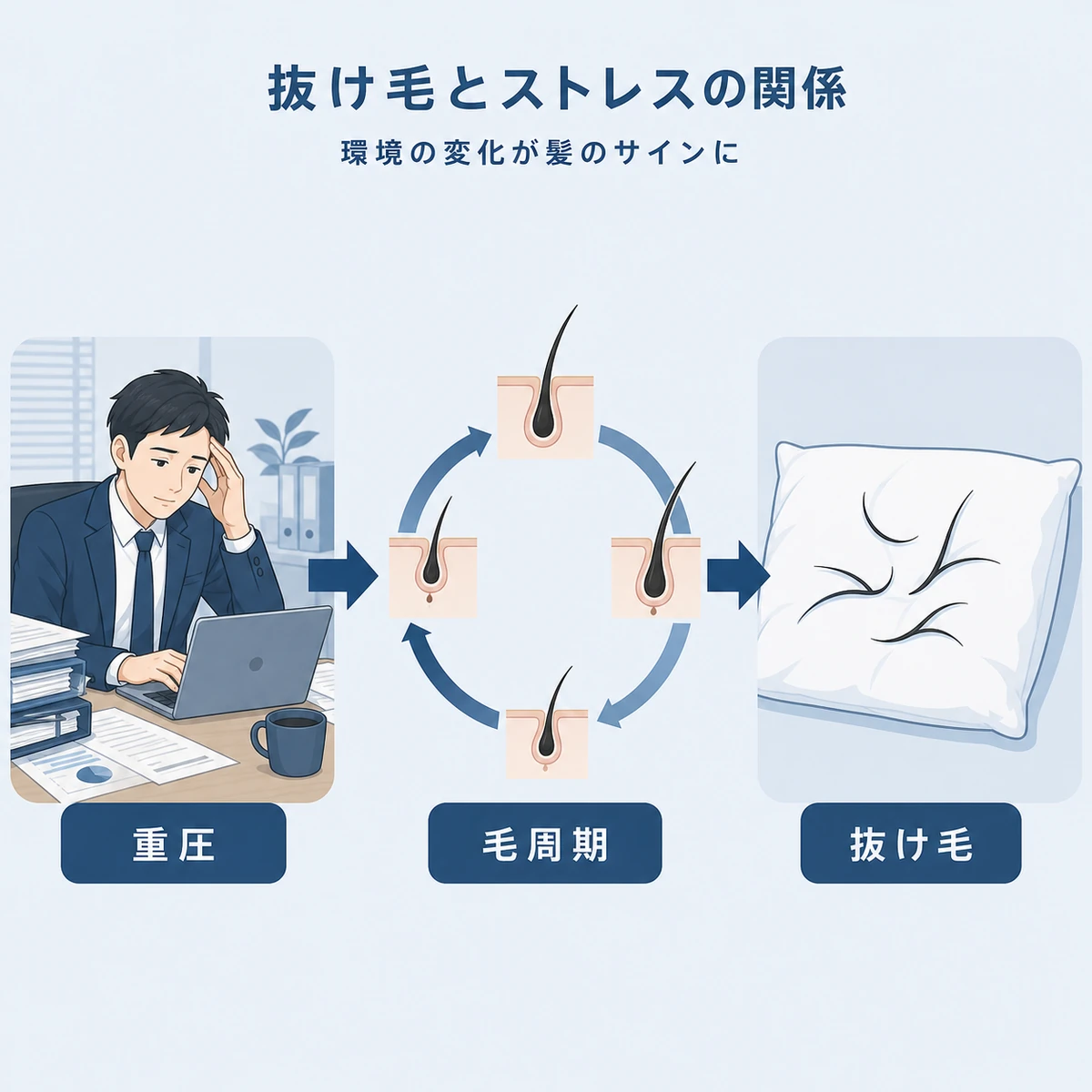 社会人男性のストレスが毛髪サイクルを乱して抜け毛につながる流れを表した医療イラスト