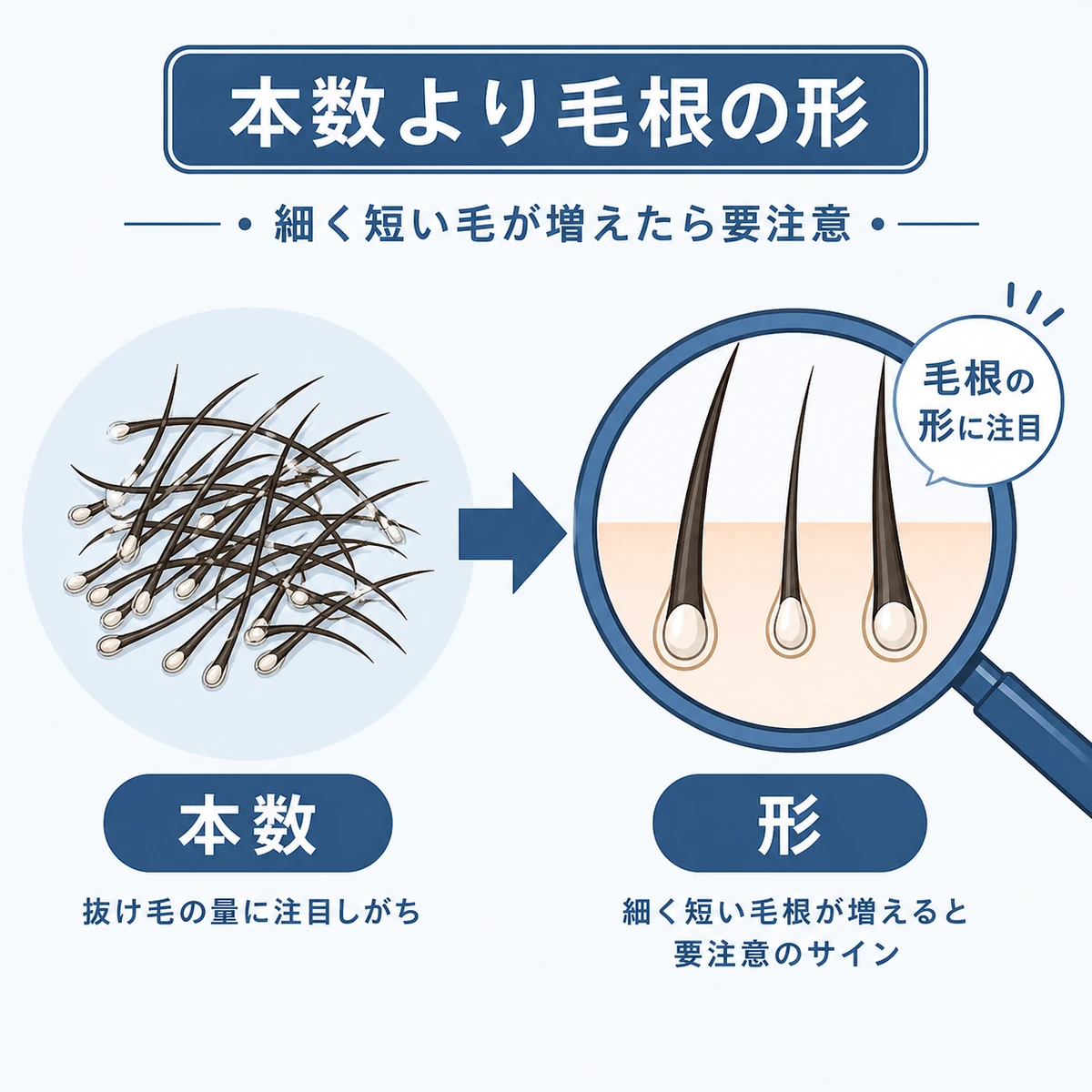 抜け毛の本数よりも毛根の形に注目する大切さを左右の対比で表した医療イラスト