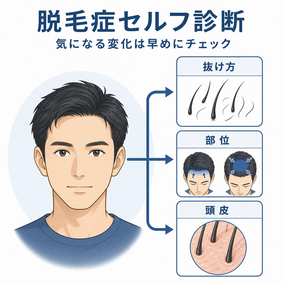 脱毛症のタイプを抜け方や部位や頭皮から見分けるセルフ診断の図解イラスト