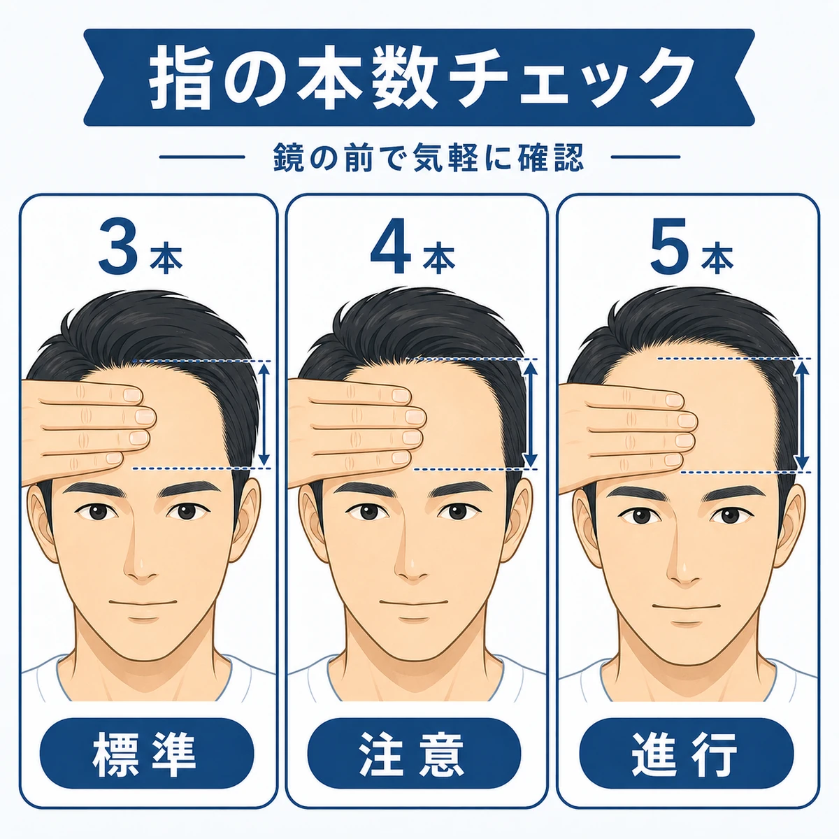 額に当てた指の本数で生え際の広さを確かめる男性を3段階で並べた医療イラスト