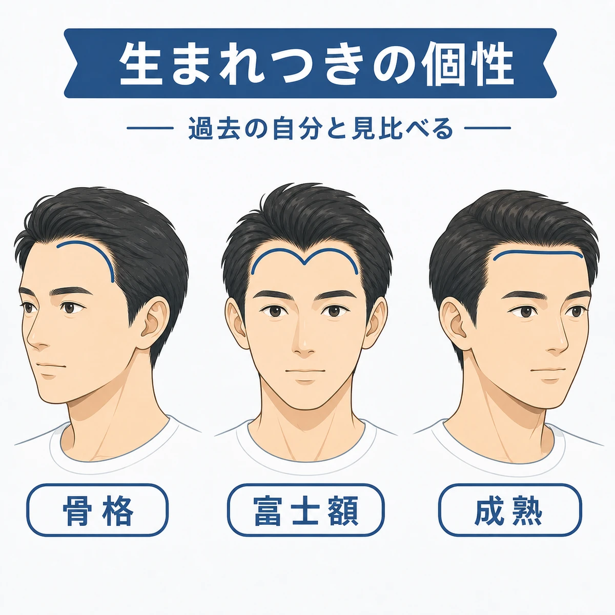 骨格や富士額など生まれ持った額の形の違いを横並びで比べた医療イラスト